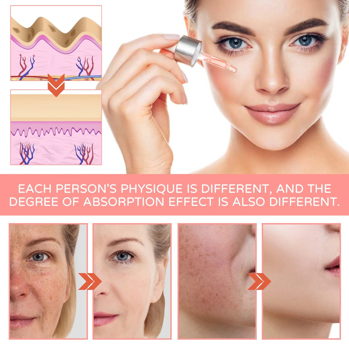 Suero Facial 5 en 1 para Reducir Líneas Finas, Reafirmante, Reduce Manchas y Pigmentación, Hidratante, Reafirmante de Piel
