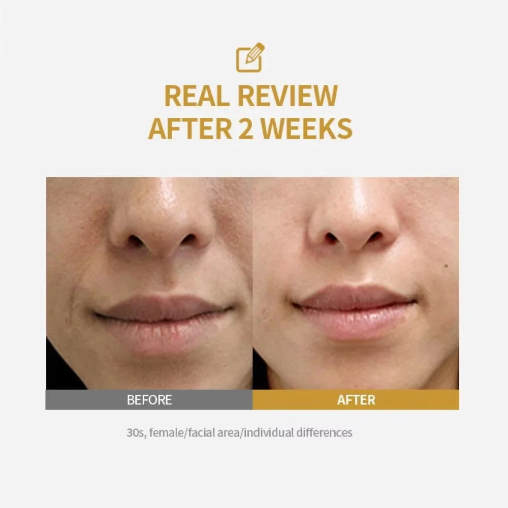 Ampolla Intensiva de Péptidos para Lifting Facial, Colágeno Profundo, Sérum Hidratante Reafirmante, Piel de Cristal, Hidratación y Reafirmación, Cuidado Facial Coreano