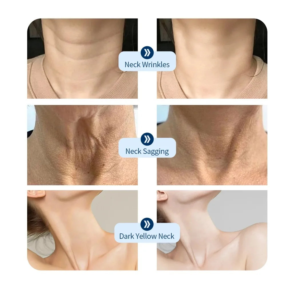 Máscara LED para el cuello, 7 colores, fotones, antiarrugas, brillo de la piel, máscara de belleza para el cuello, estiramiento de la piel, eliminador de arrugas del cuello, cuidado de la piel