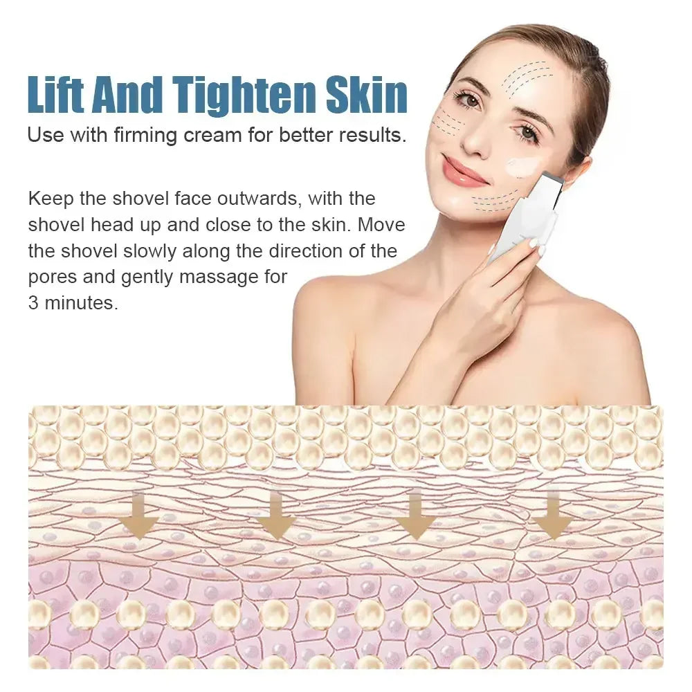 Limpiador Facial de piel con vibración profunda, pala, espátula no ultrasónica, exfoliante Facial, eliminador de espinillas, Ma ssager Facial