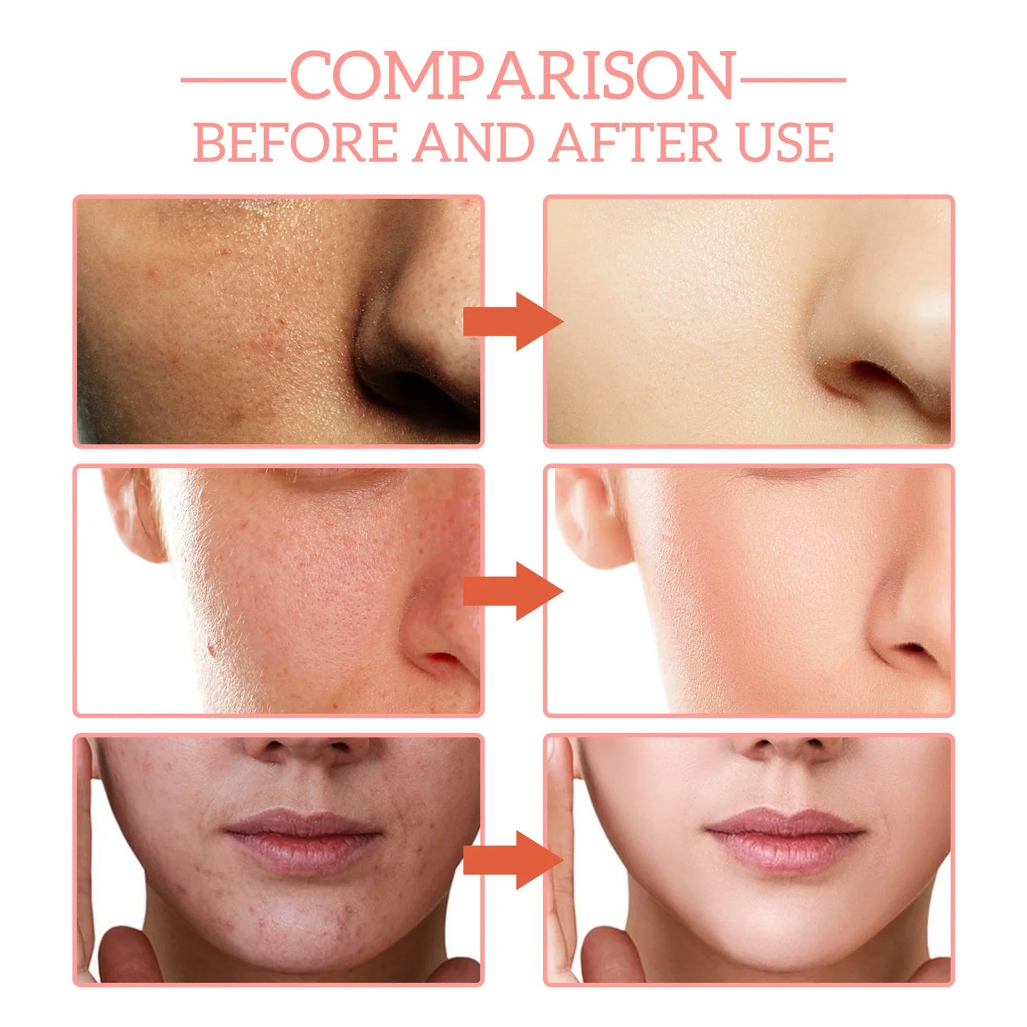 Suero Facial 5 en 1 para Reducir Líneas Finas, Reafirmante, Reduce Manchas y Pigmentación, Hidratante, Reafirmante de Piel